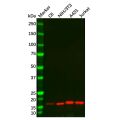 Recombinant NM23A Antibody