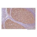 Recombinant NM23A Antibody