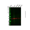 Recombinant Nucleophosmin Antibody