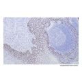 Recombinant p40 - DeltaNp63 Antibody