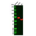Recombinant NGFR Antibody