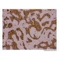 Recombinant pan Cytokeratin Antibody