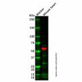 PFKFB2 Antibody