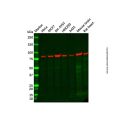 Recombinant PFKM Antibody
