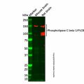 Phospholipase C beta 1/PLCB1 Mouse mAb
