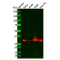 Recombinant PIM1 Antibody