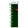 Recombinant PKN2 Antibody