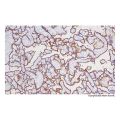 Recombinant Placental alkaline phosphatase (PLAP) Antibody