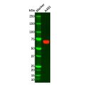 Placental alkaline phosphatase (PLAP) Antibody