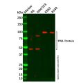 PML Protein Antibody