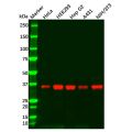 PP1C gamma Mouse mAb