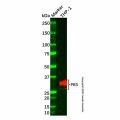 Recombinant PR3 Antibody