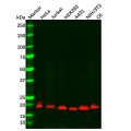 Recombinant Presenilin 1/PS-1 Antibody