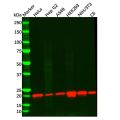 Recombinant Presenilin 2/AD5 Antibody