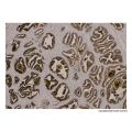 Recombinant Prostate Specific Antigen Antibody