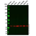 Recombinant Proteasome 20S C2/HC2 Antibody