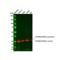 Recombinant PSMB10/MECL1 Antibody