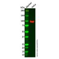 PYGL Antibody