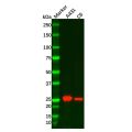 RAB27B Mouse mAb