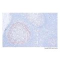 Recombinant Rb Antibody