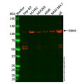 RBM5 Antibody