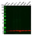 Recombinant RBX1 Antibody