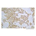 Recombinant Renal Cell Carcinoma (gp200) Antibody