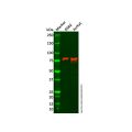 Recombinant RNase L Antibody