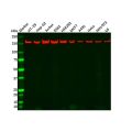 Recombinant ROCK1 Antibody