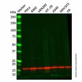 Recombinant RPS19 Antibody