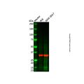 Recombinant RPS6 Antibody