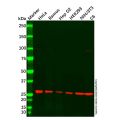Recombinant SLC31A1/CTR1 Antibody