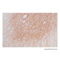 Recombinant Somatostatin Receptor 2 Antibody