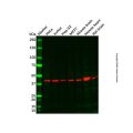 Recombinant Somatostatin Receptor 5 Antibody