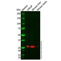 Recombinant SRD5A2 Antibody