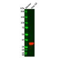 Recombinant SULT2A1 Antibody