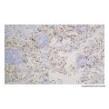 Recombinant Surfactant Protein B Antibody