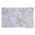 Recombinant TAG-72 Antibody