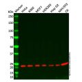 Recombinant TCTP Antibody