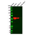Recombinant TdT Antibody