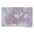 Recombinant TdT Antibody