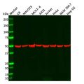 TGF beta Receptor I Antibody