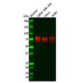 Recombinant TGF beta Receptor II Antibody