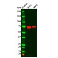 TGFBI Antibody