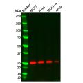 Thymidine Kinase 1/TK1 Mouse mAb