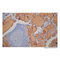 Recombinant Thyroglobulin Antibody