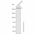 Recombinant Thyroglobulin Antibody