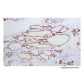 Recombinant Thyroid Peroxidase/TPO Antibody