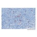 Recombinant TIA1 Antibody