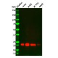 TIMP2 Mouse mAb